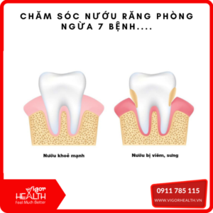 nuou rang 1
